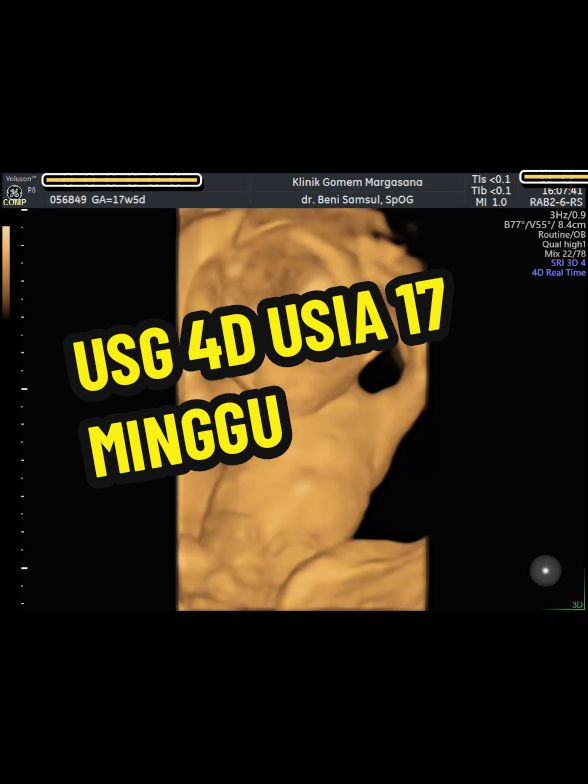@USG 4D PURWOKERTO