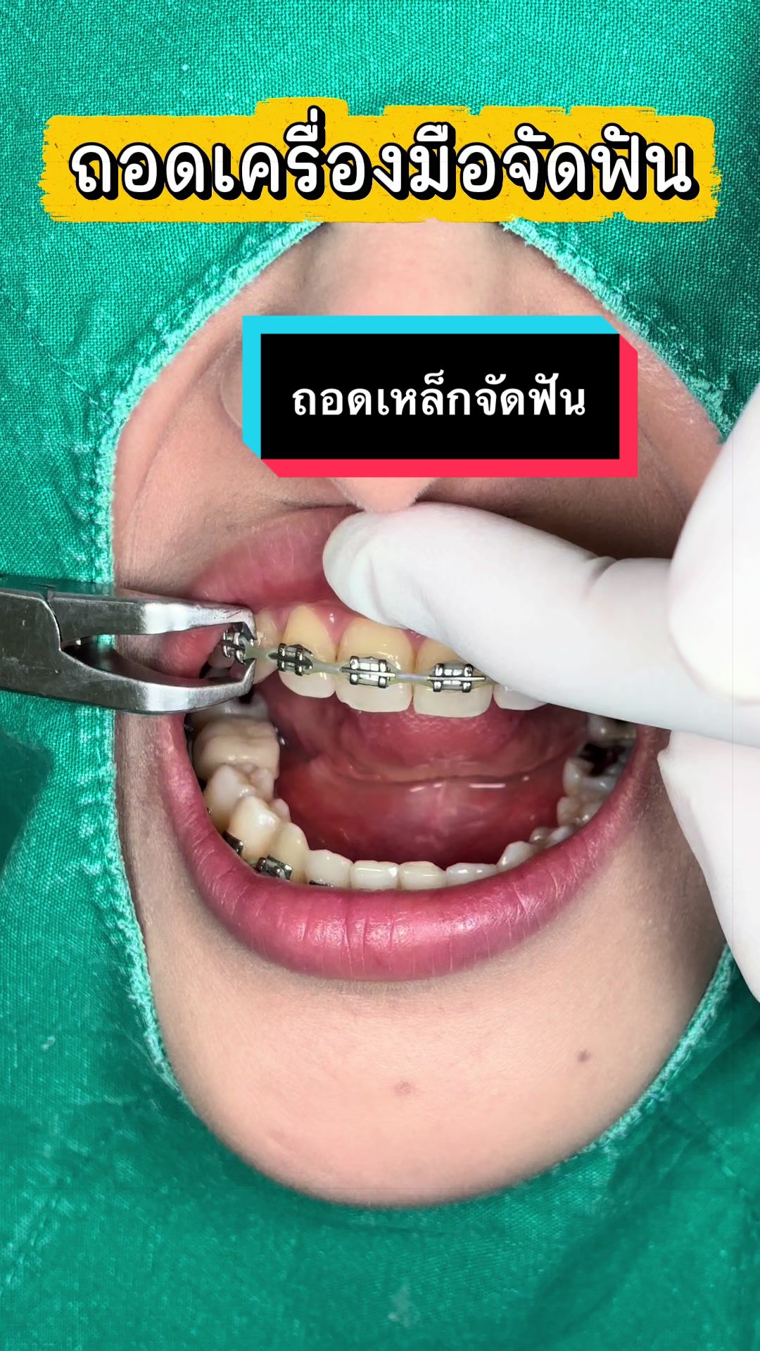 @ซอฟแอนด์สไมล์ลาดกระบัง