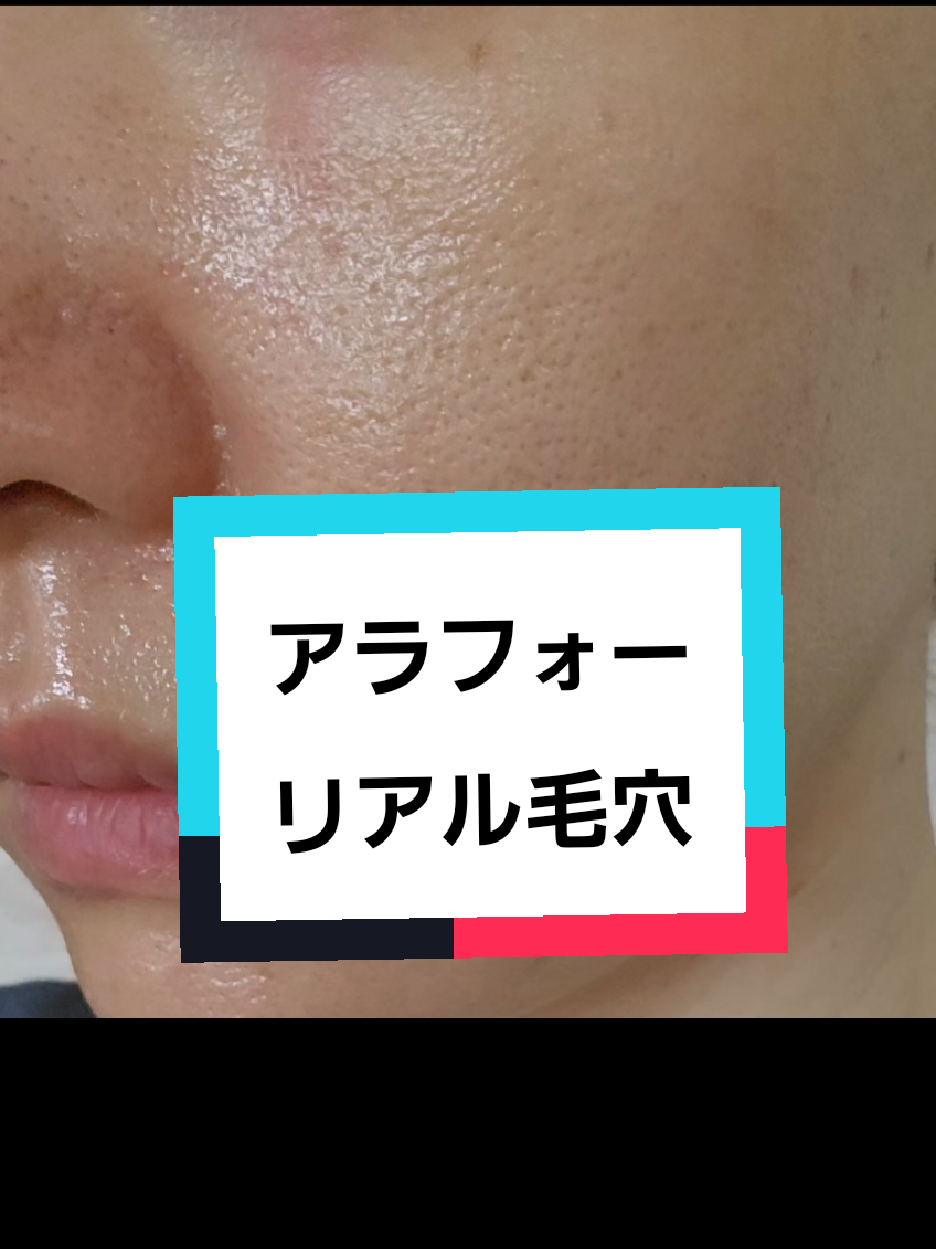 @リアル毛穴改善記録