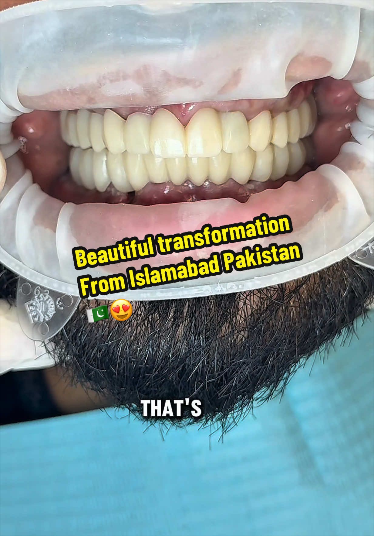 @Dr Haroon Shah
