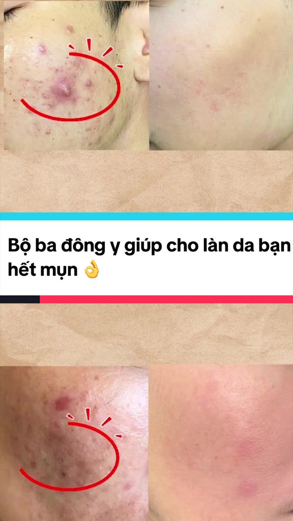 @Ho&agrave;ng Anh N Beauty