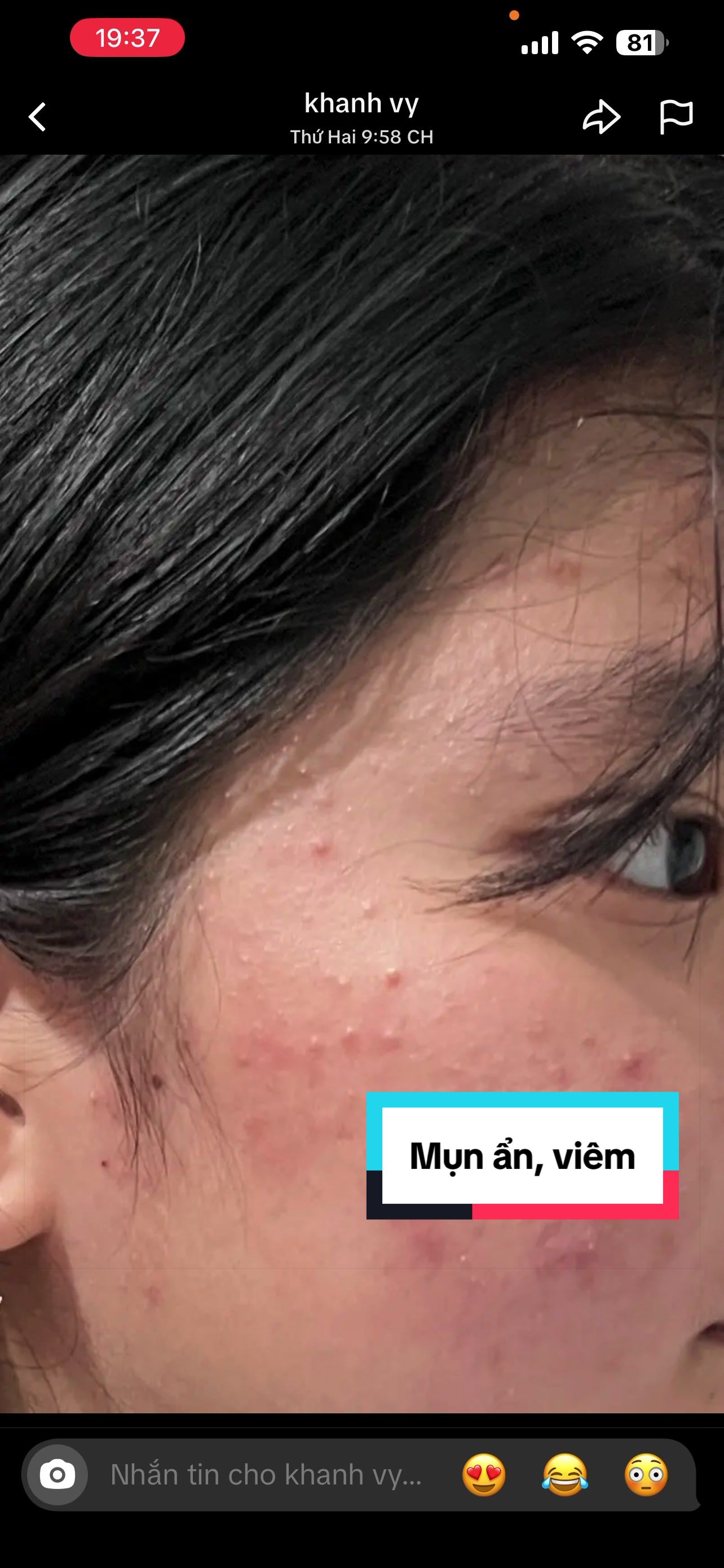 @Thảo NT Skincare
