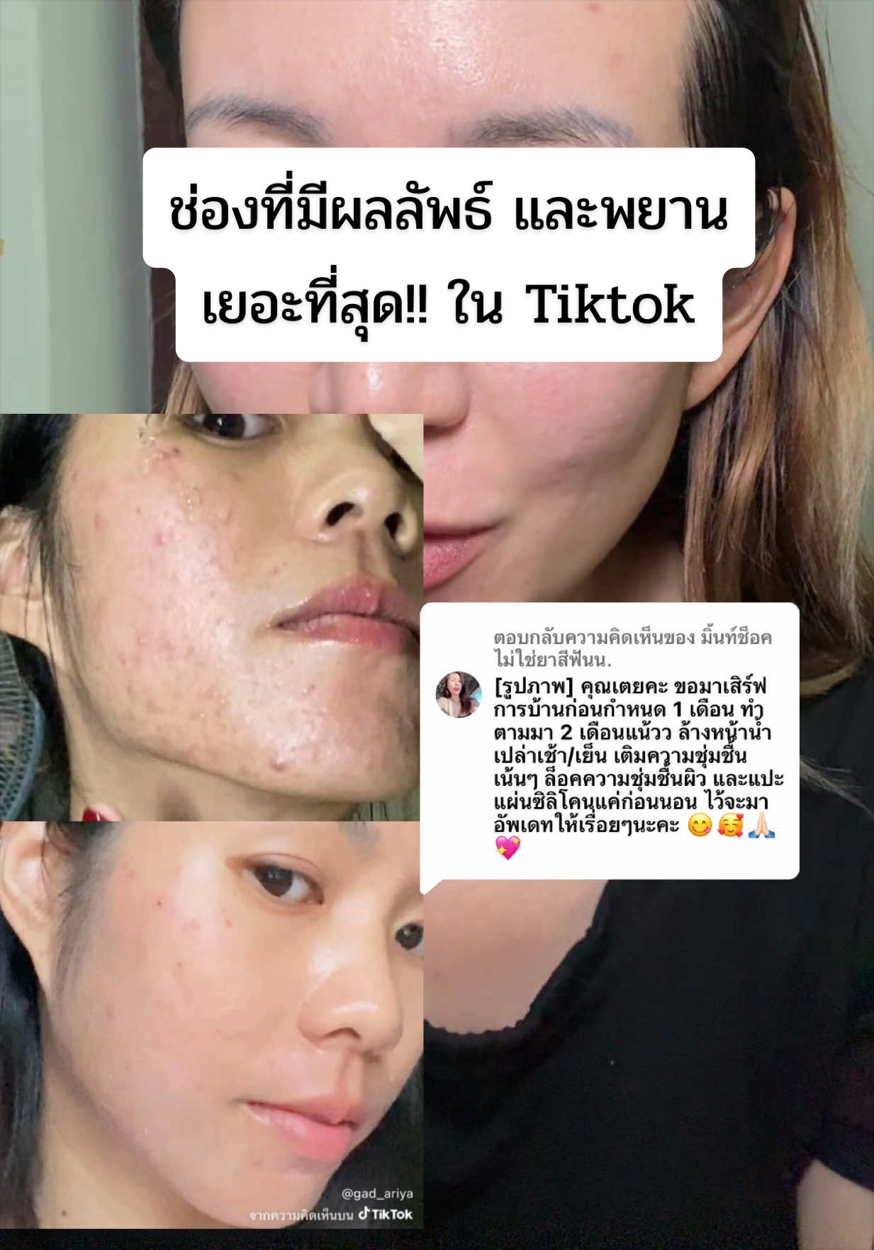 @belittlenerdช่องคุณเตย
