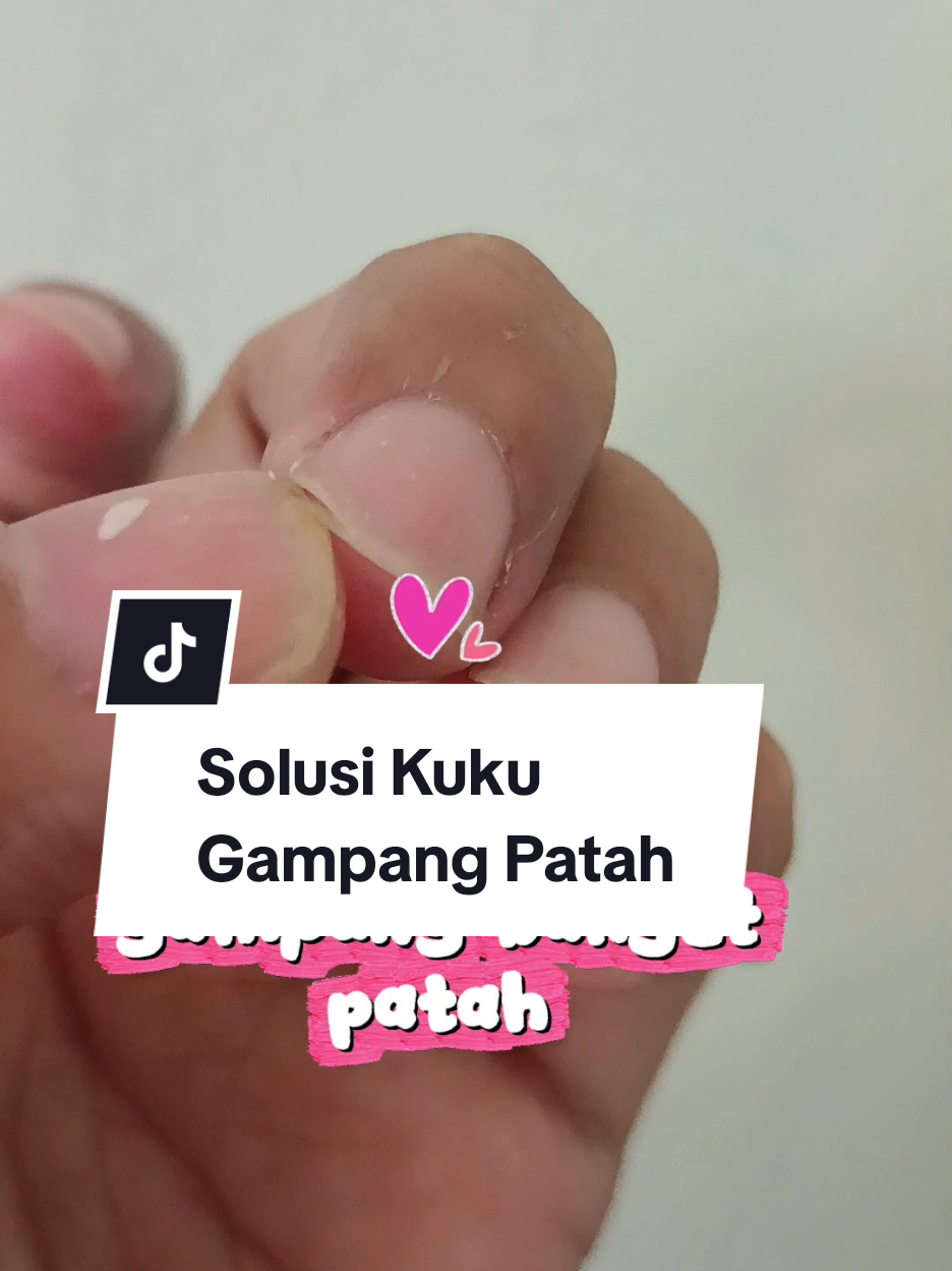 @Mbak Dee