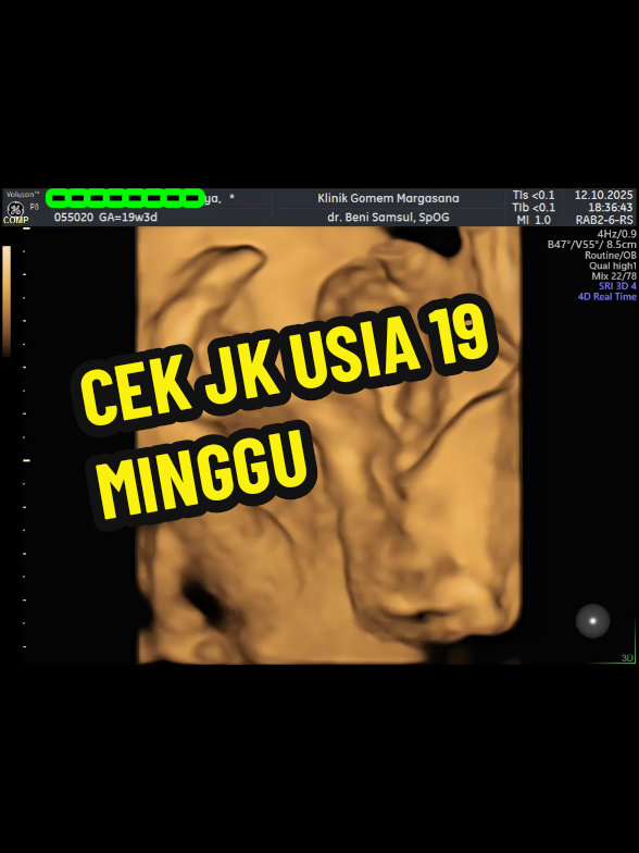 @USG 4D PURWOKERTO