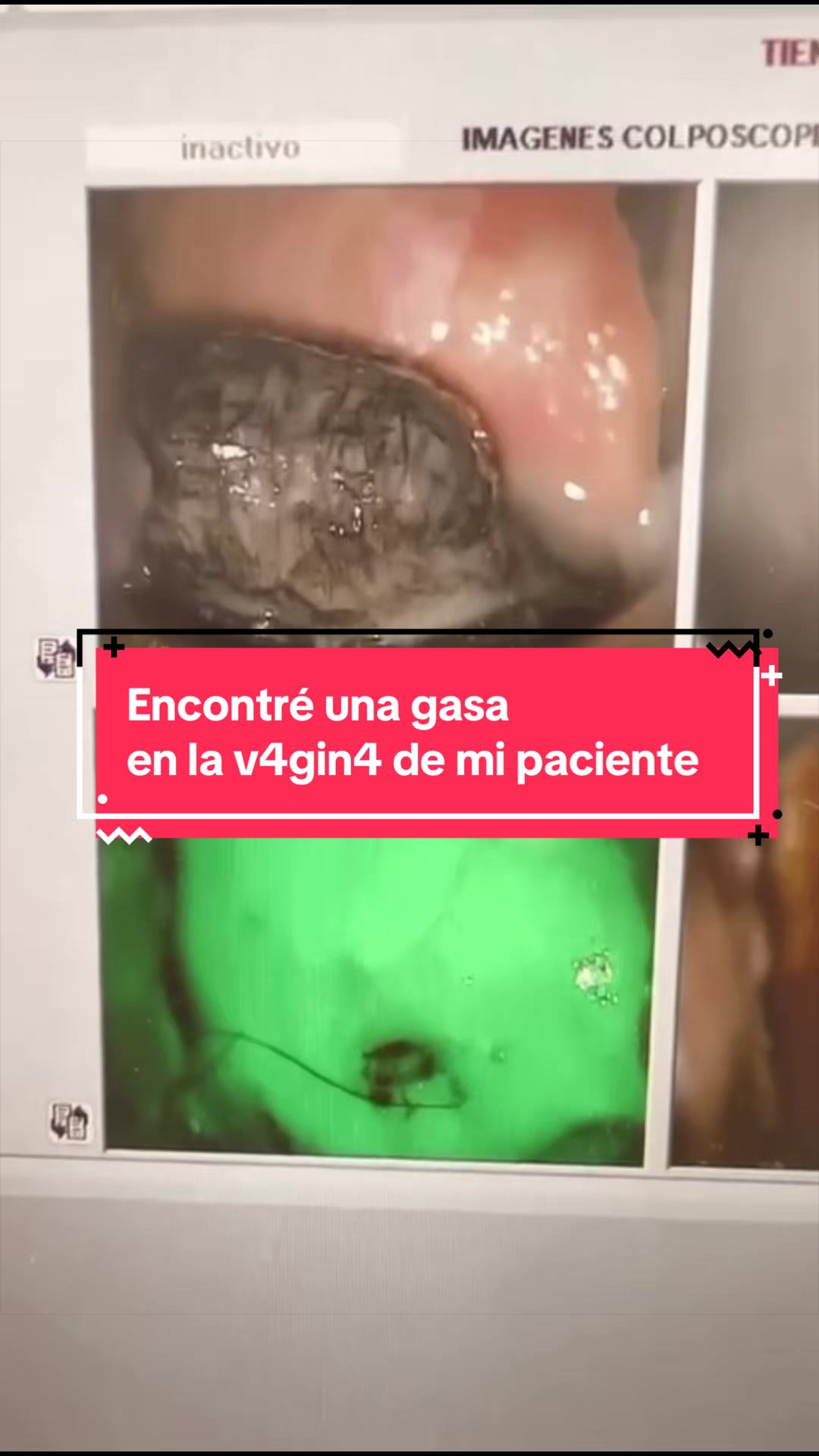 @Dra. Verónica Reyes Ginecóloga