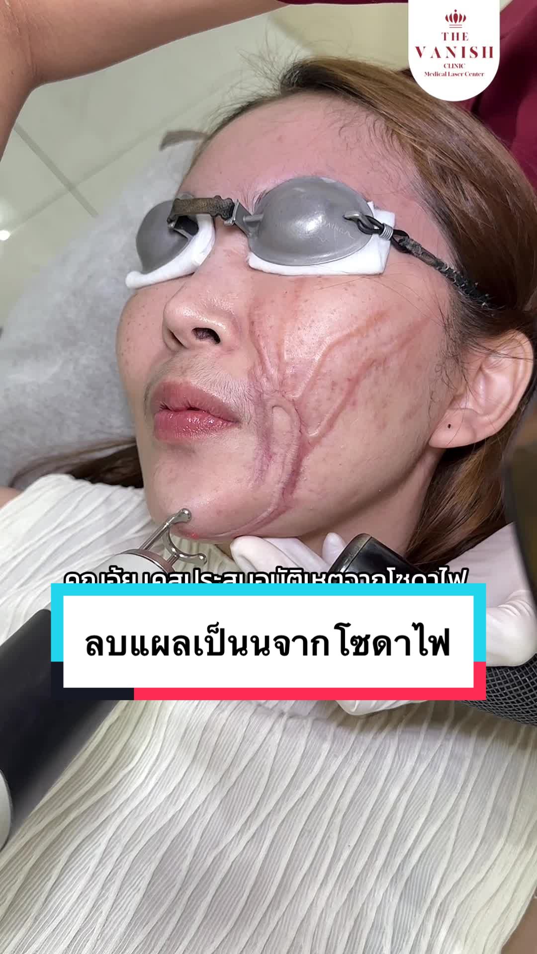 @The vanish clinic