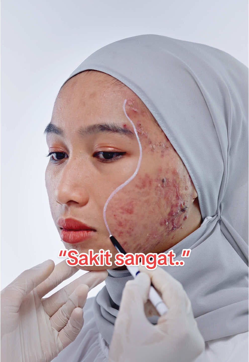@AINAA
