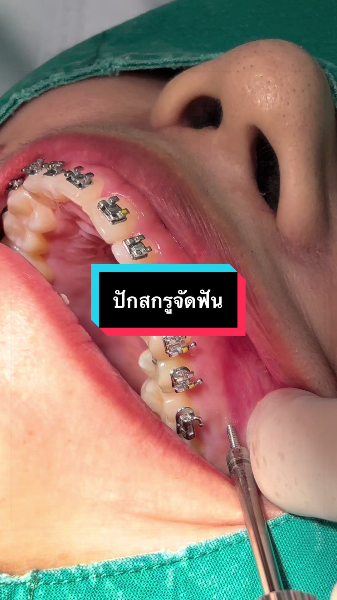@ซอฟแอนด์สไมล์ลาดกระบัง
