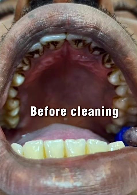 @Whiten Lighten TAC