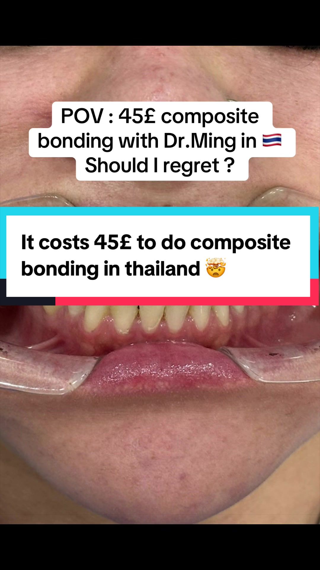 @Dr.MingSmile &hearts;️ Bangkok&Krabi