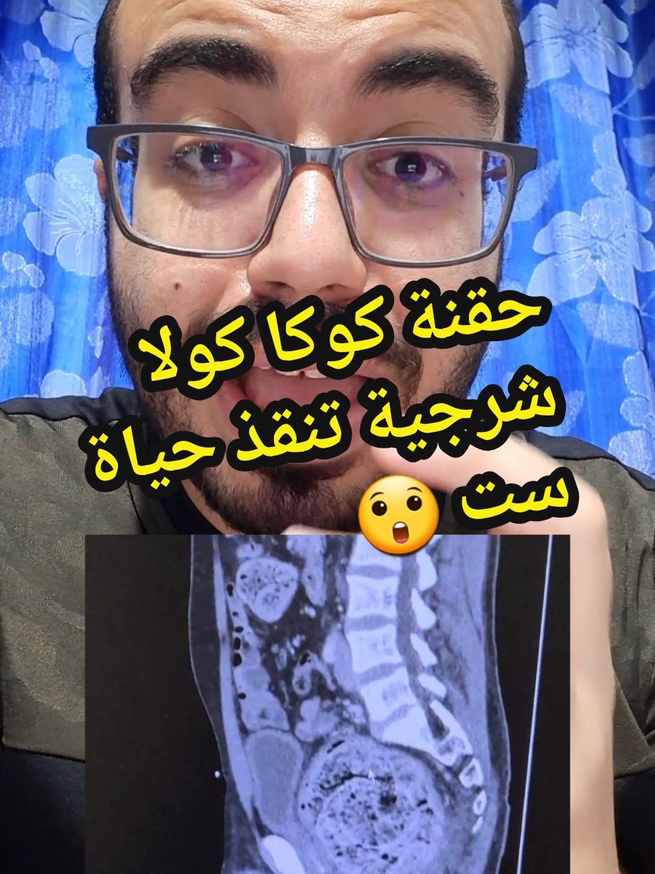 @Dr.ahmedsherif