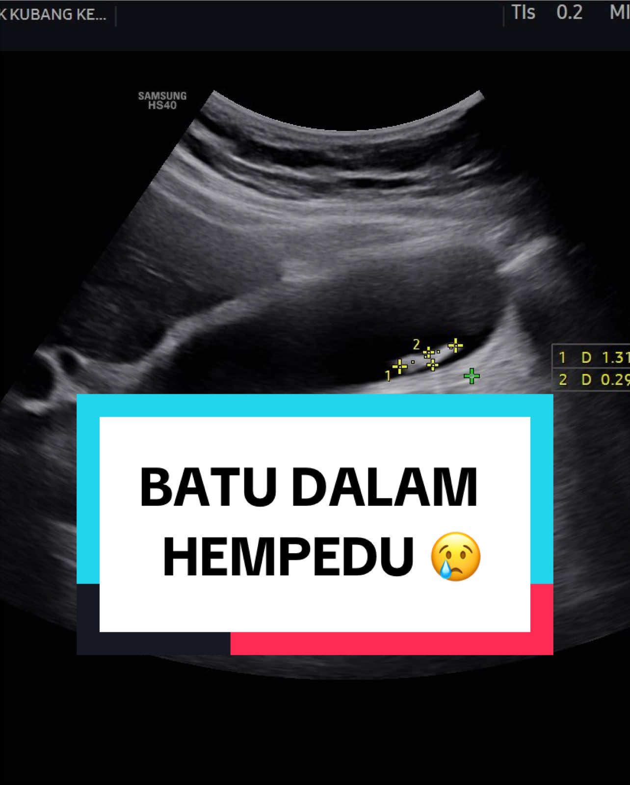@Rawatan Kulit,Echo,Antenatal