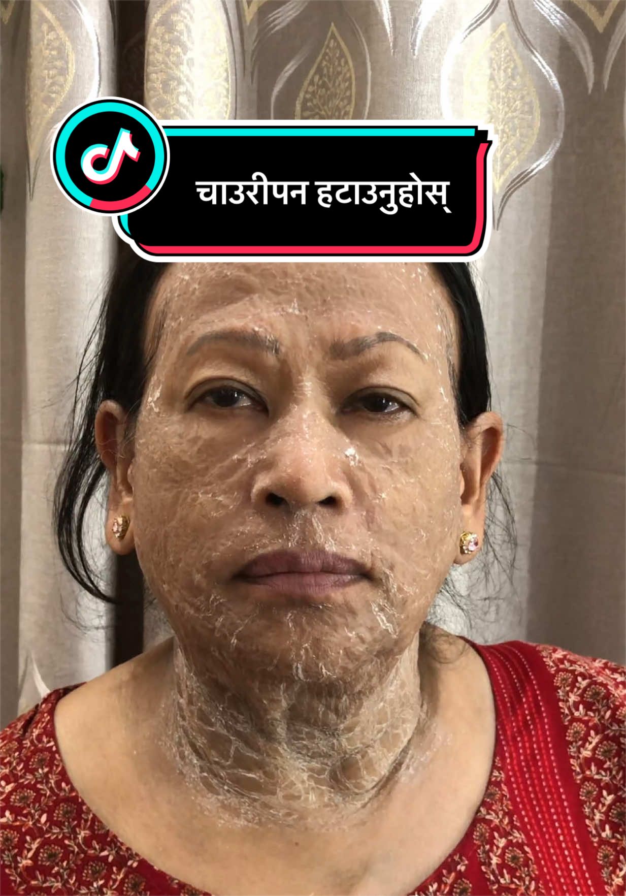 @Minimagic Skincare🇳🇵