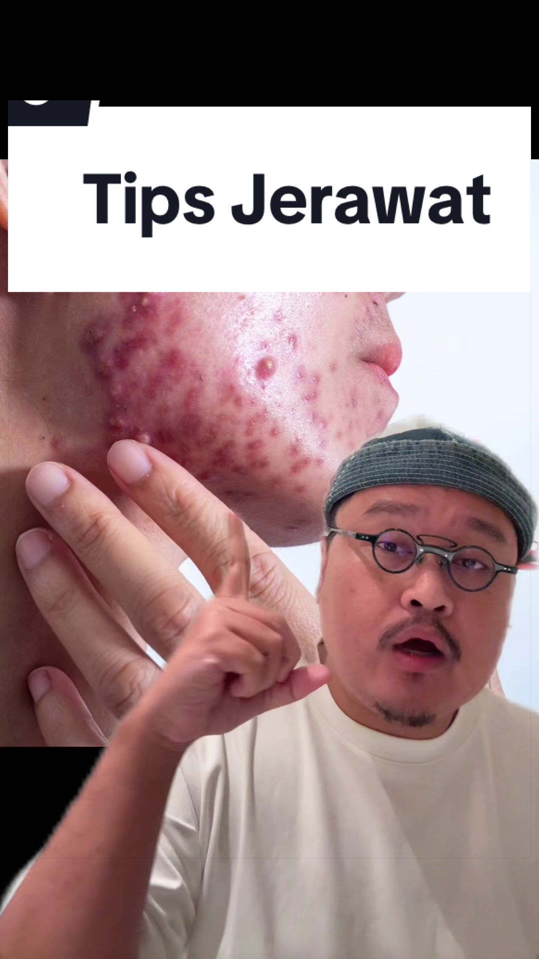 @Ali | @HungryForSkincare