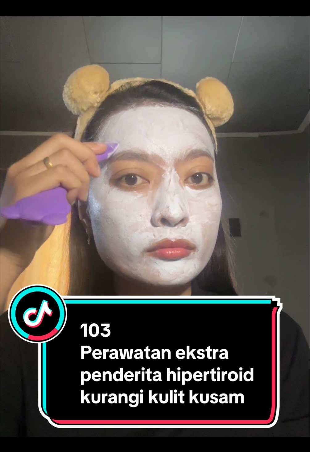 @Fionalois Pertiwi
