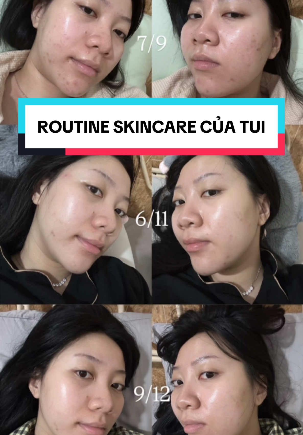 @Nguyễn Ngọc Xuân Nhi