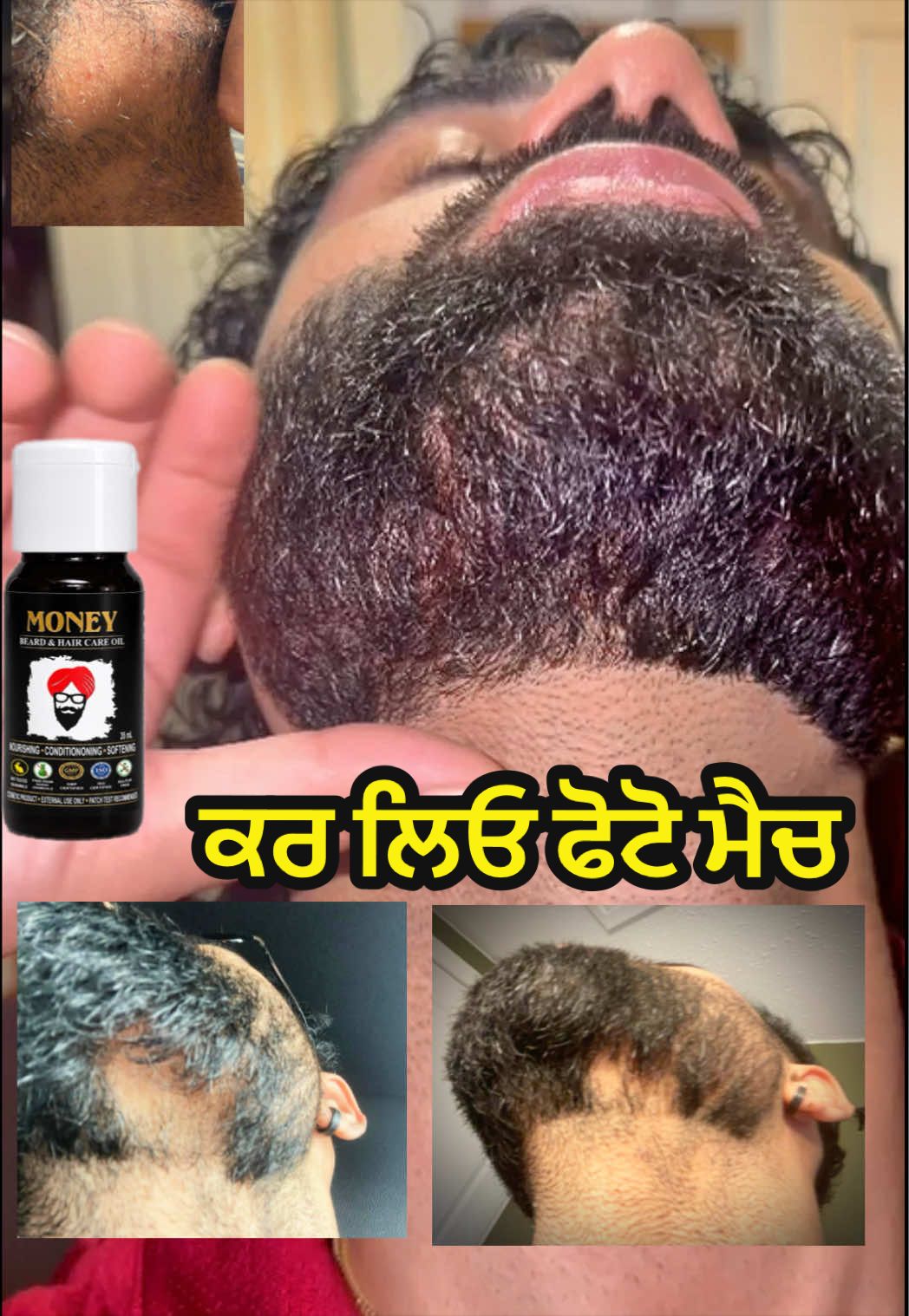 @money_beard_growthoil