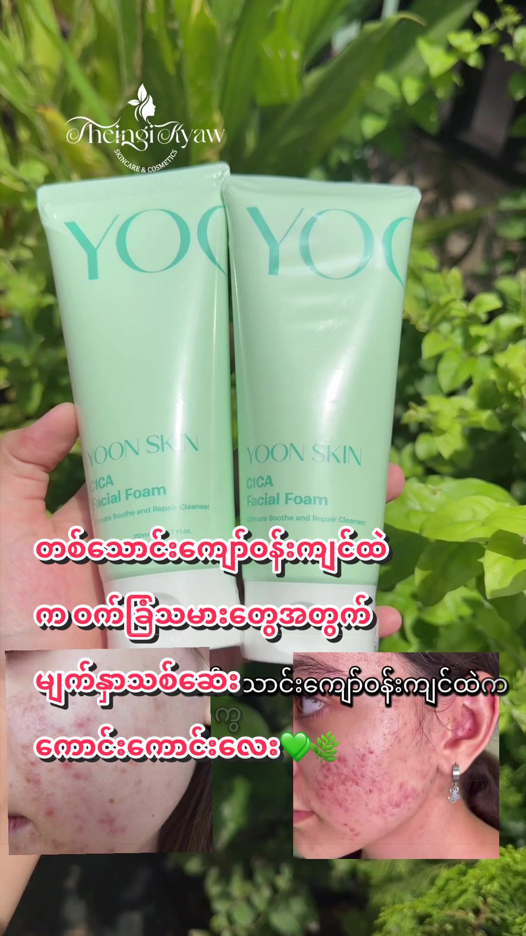 @FB: TheingiKyawSkincareShop