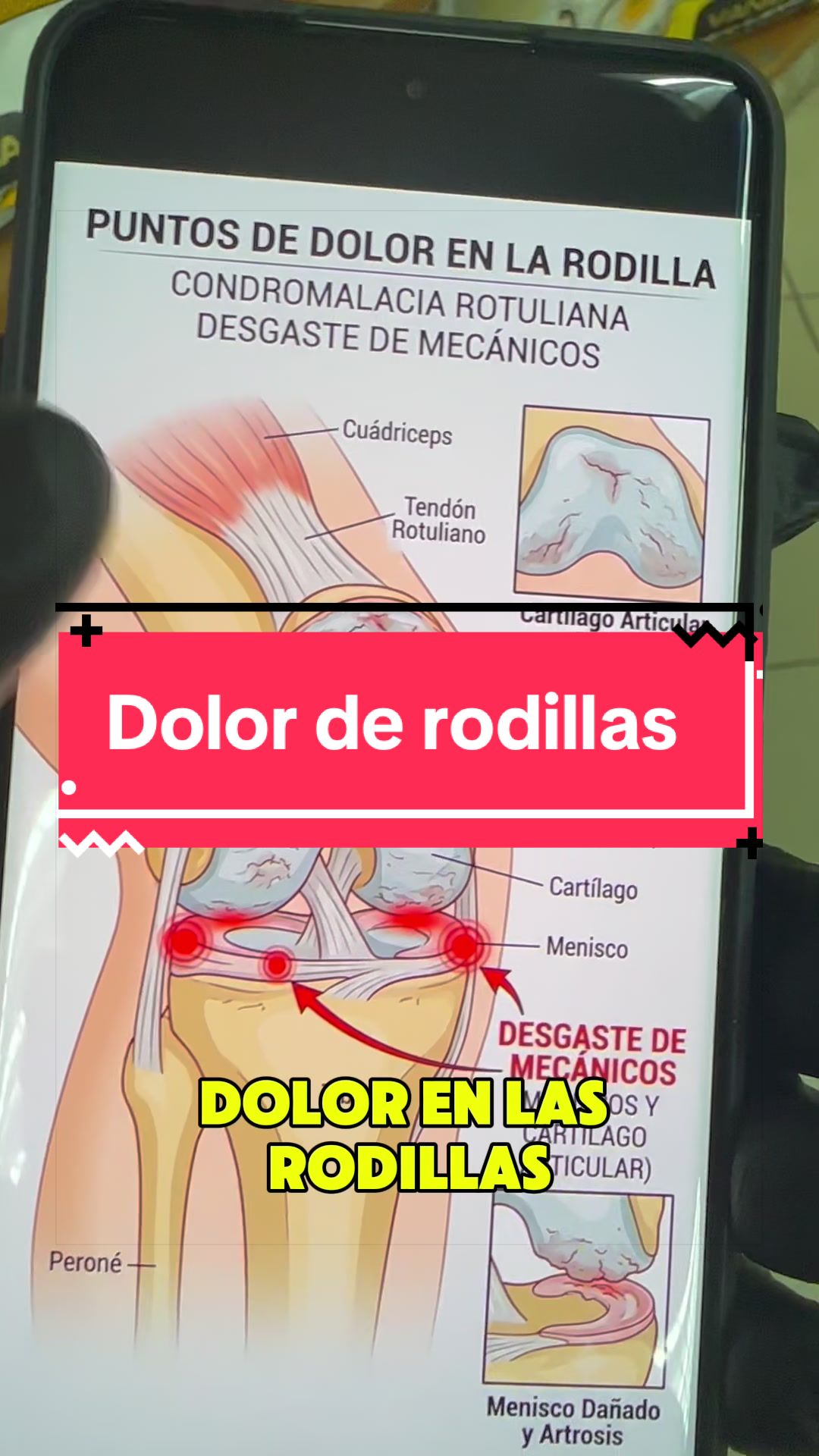 @elsuplementos☑️