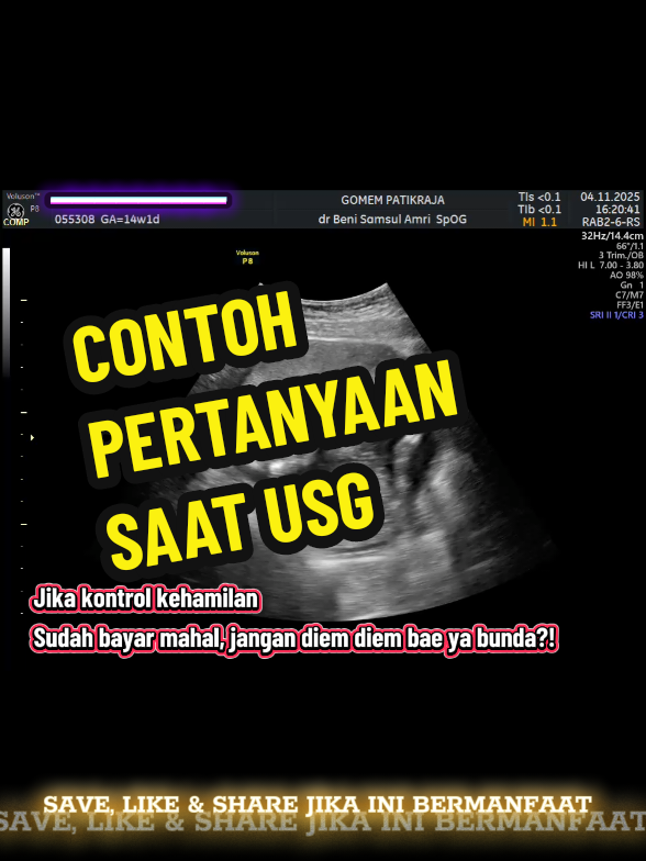 @USG 4D PURWOKERTO