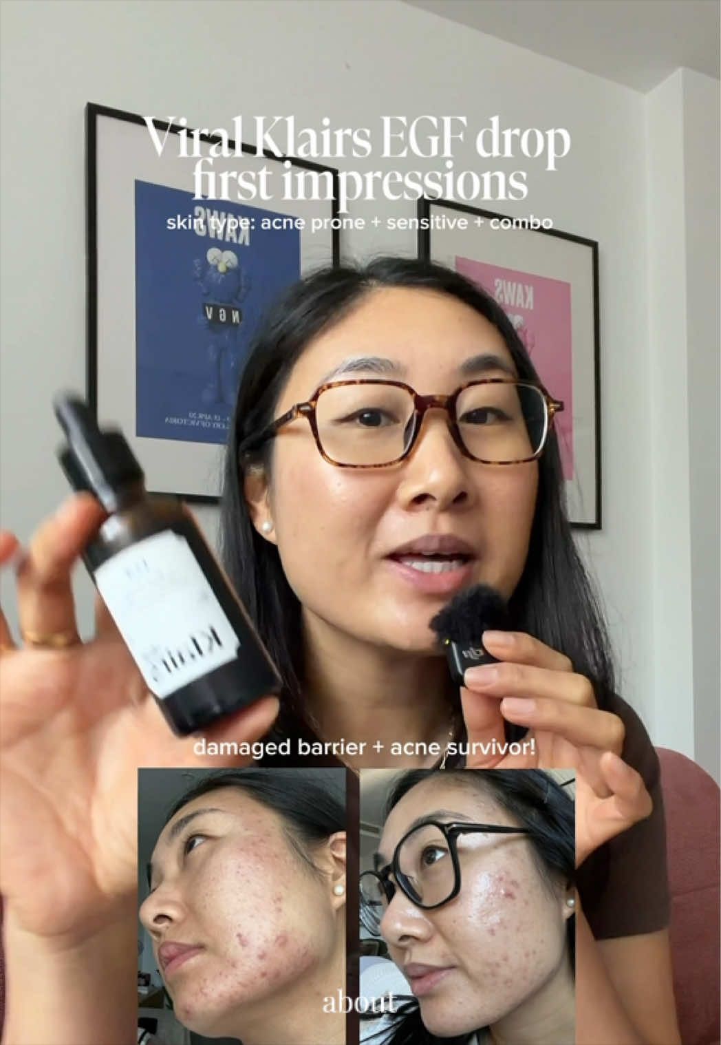 @Lisa | acne &rarr; clear skin