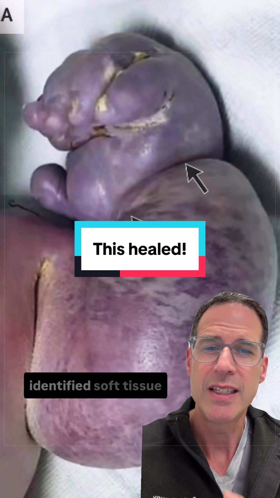 @Dr Michael Narvey 🇨🇦