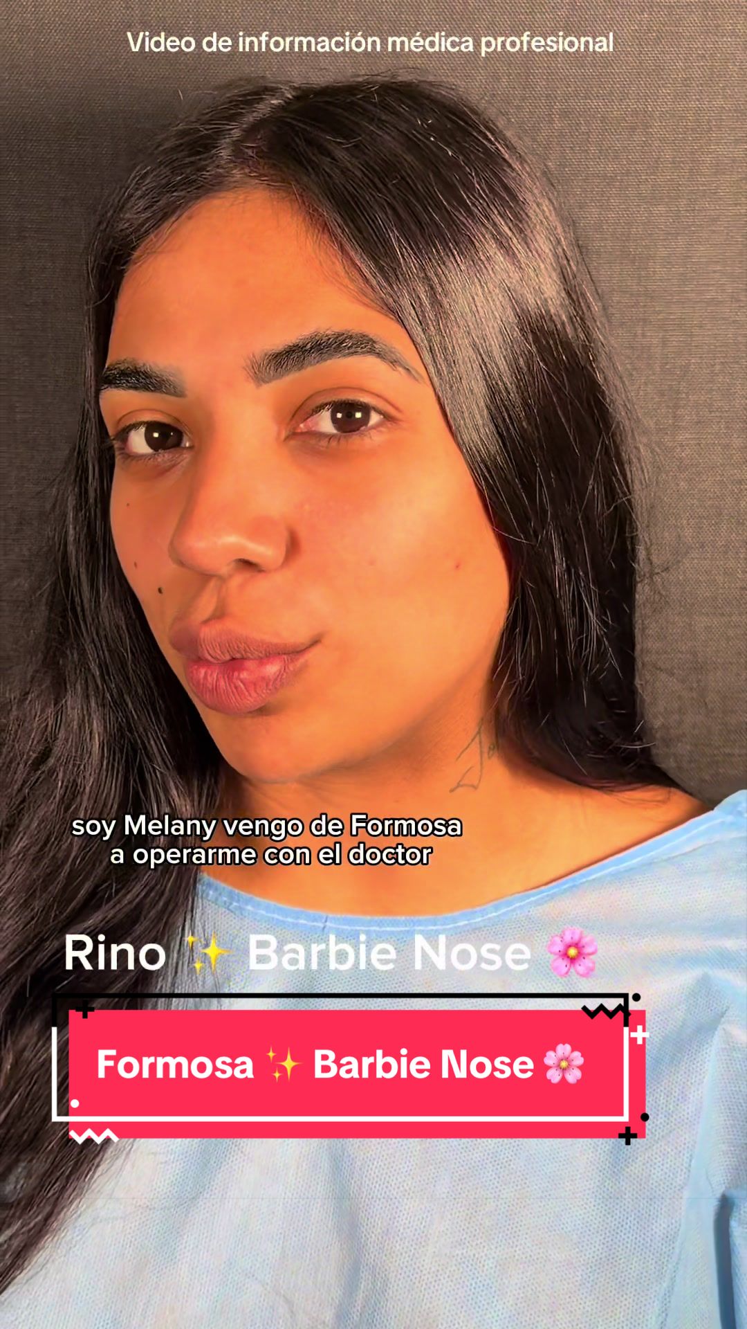 @drgarone.rinoplastia