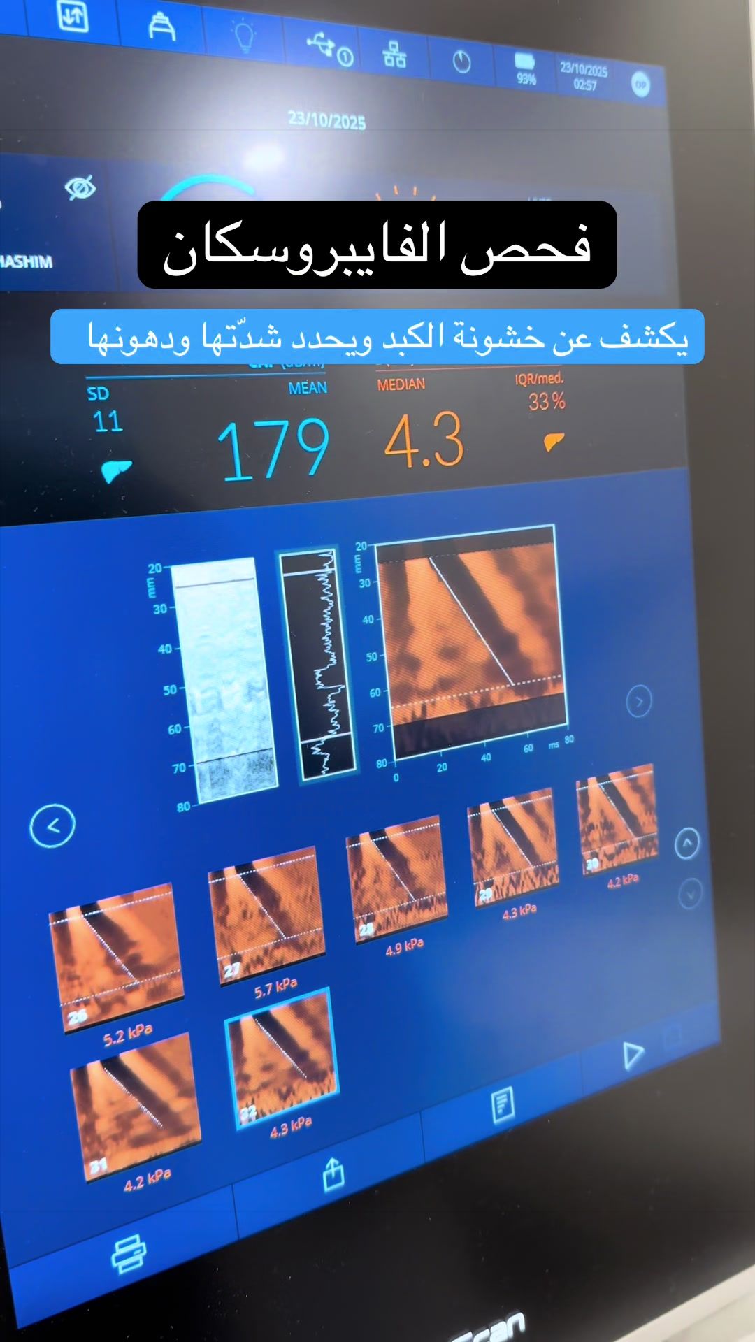 @مركز الجهاز الهضمي المتكامل