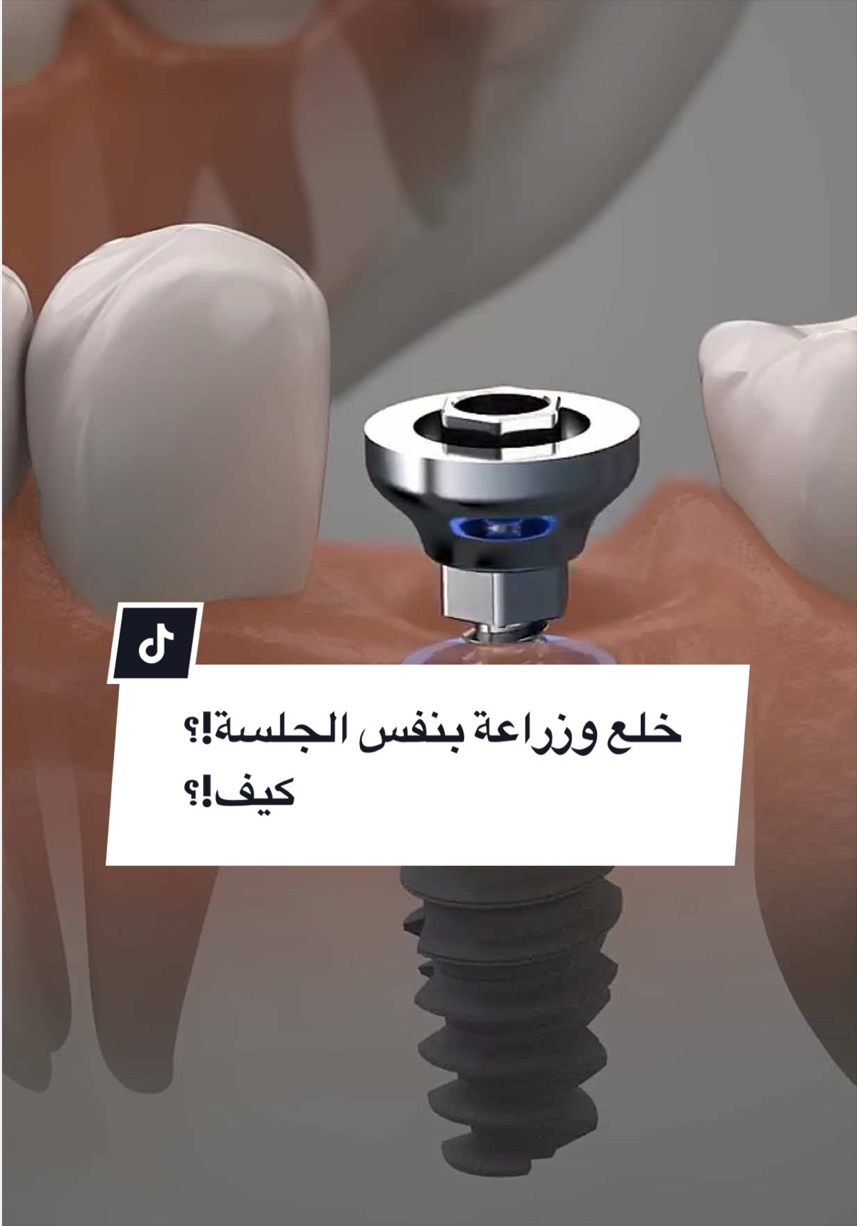 @مركز الابتسامة الرائعة الطبي