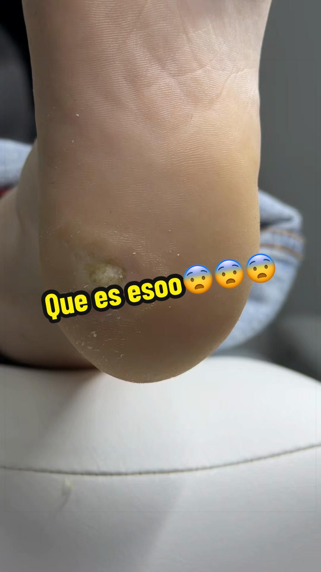 @podología calzada