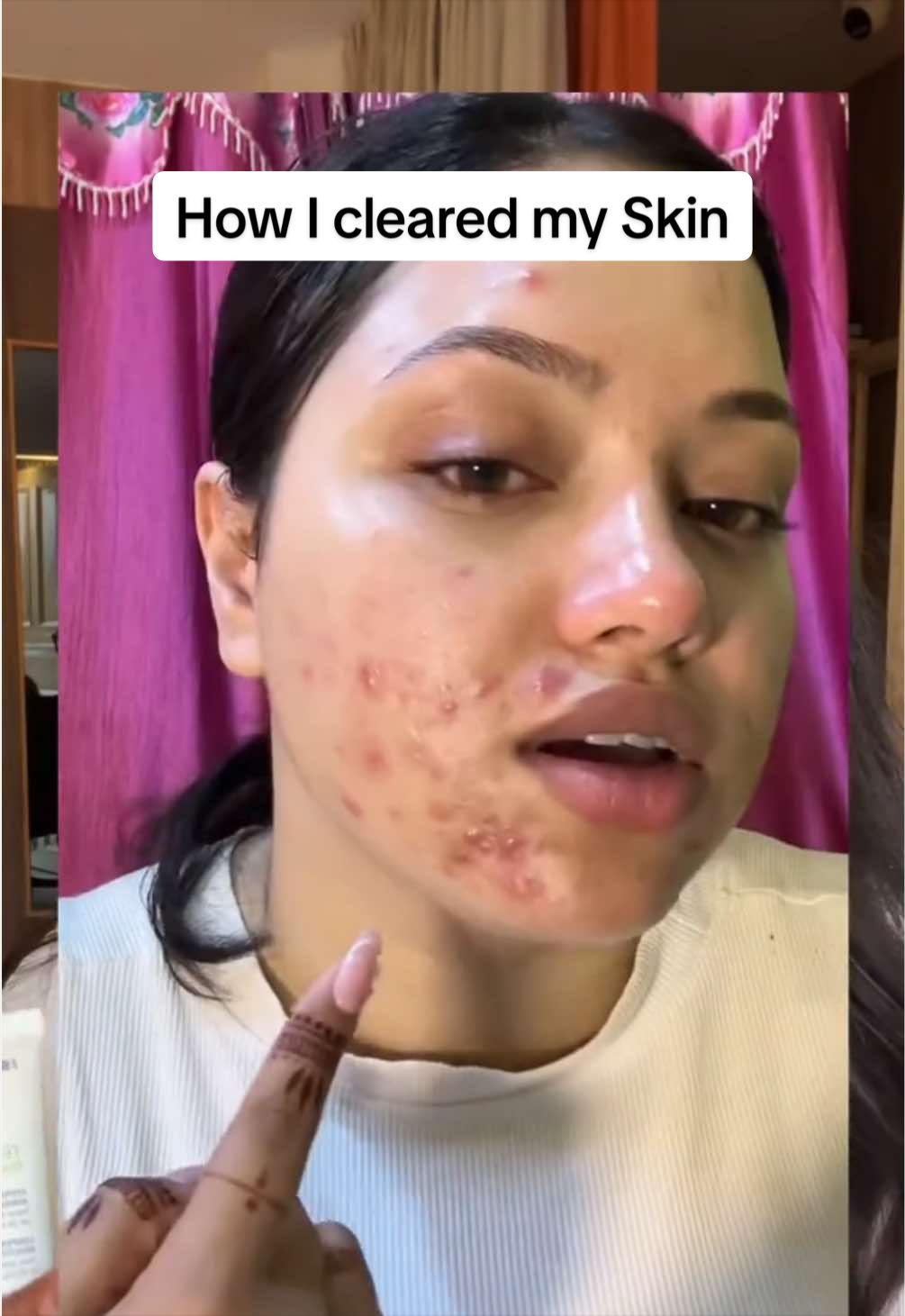 @MISHISA