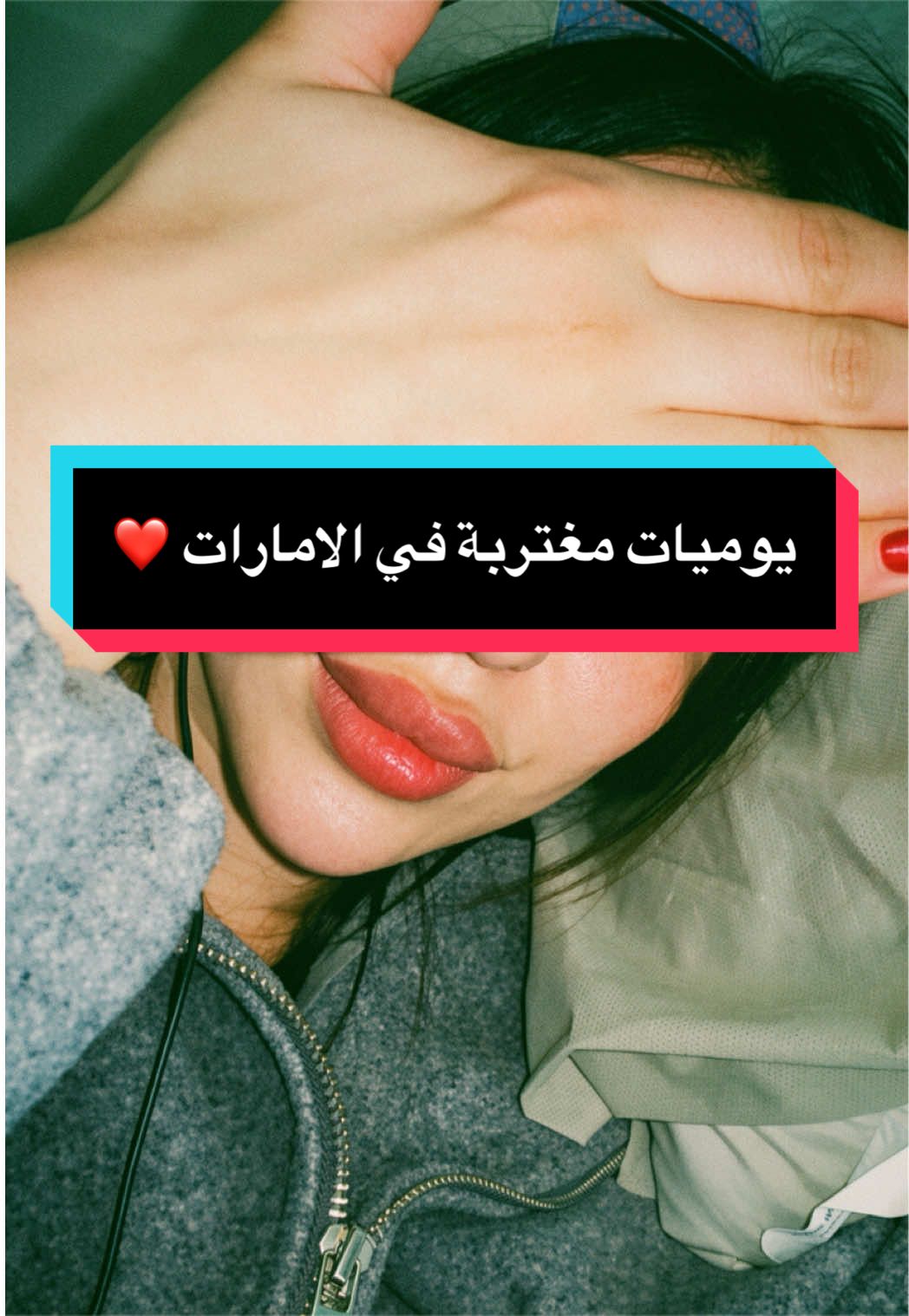@نـــونــــي 🩰🦩