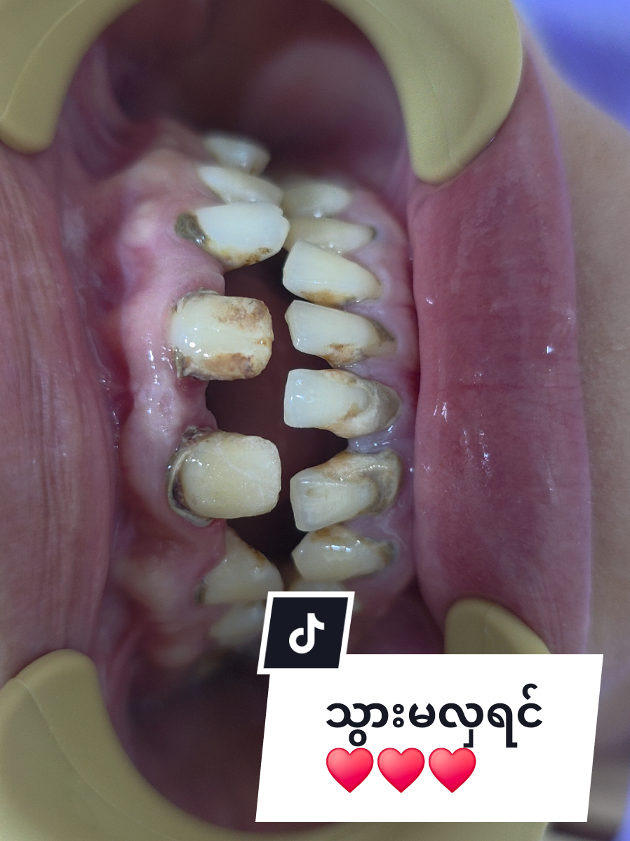 @Dr.KoKoSawMin(သွားဆရာဝန်)