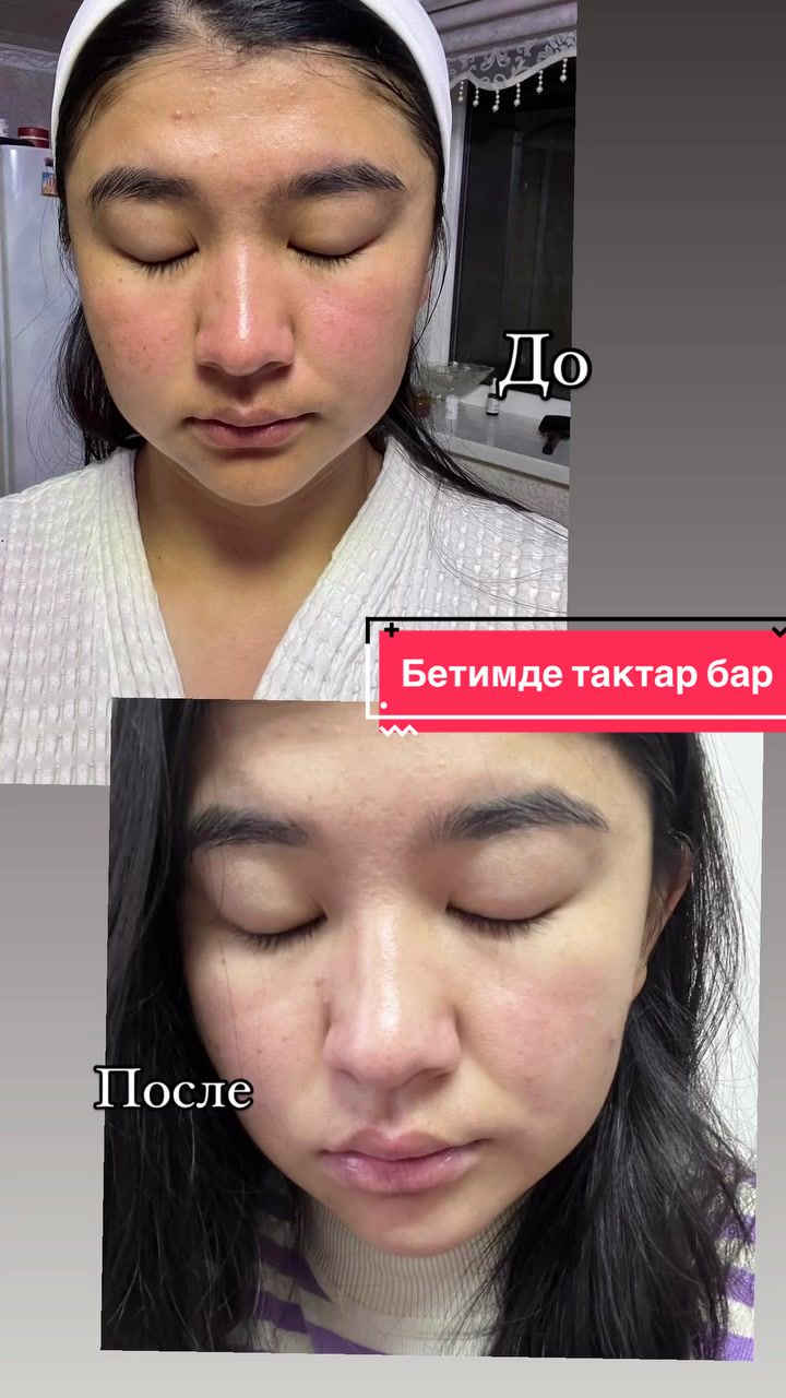 @Бермет Нурланбекова