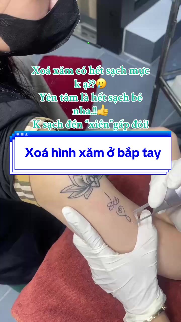 @Xo&aacute; xăm k sẹo H&agrave; Nội💧