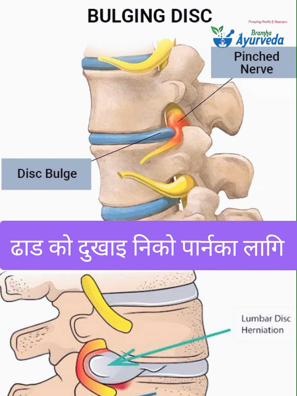 @Bramha Ayurveda