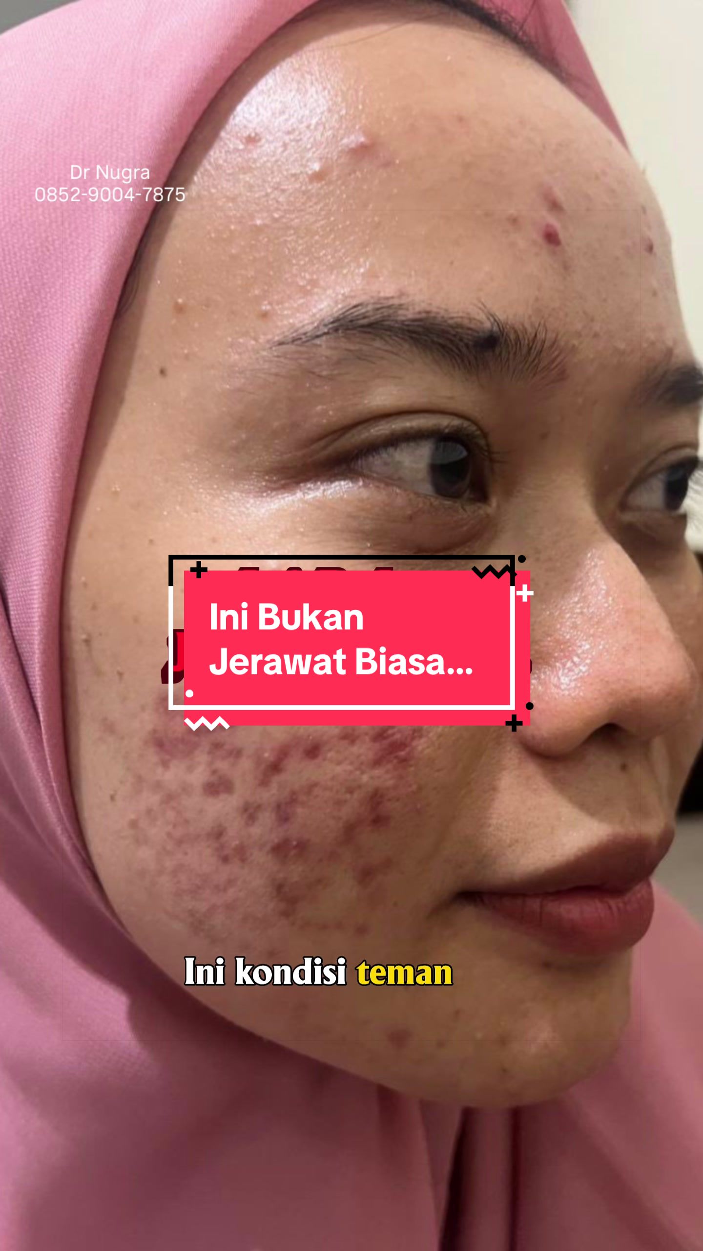 @Dr.Nugra_TWS Consultant
