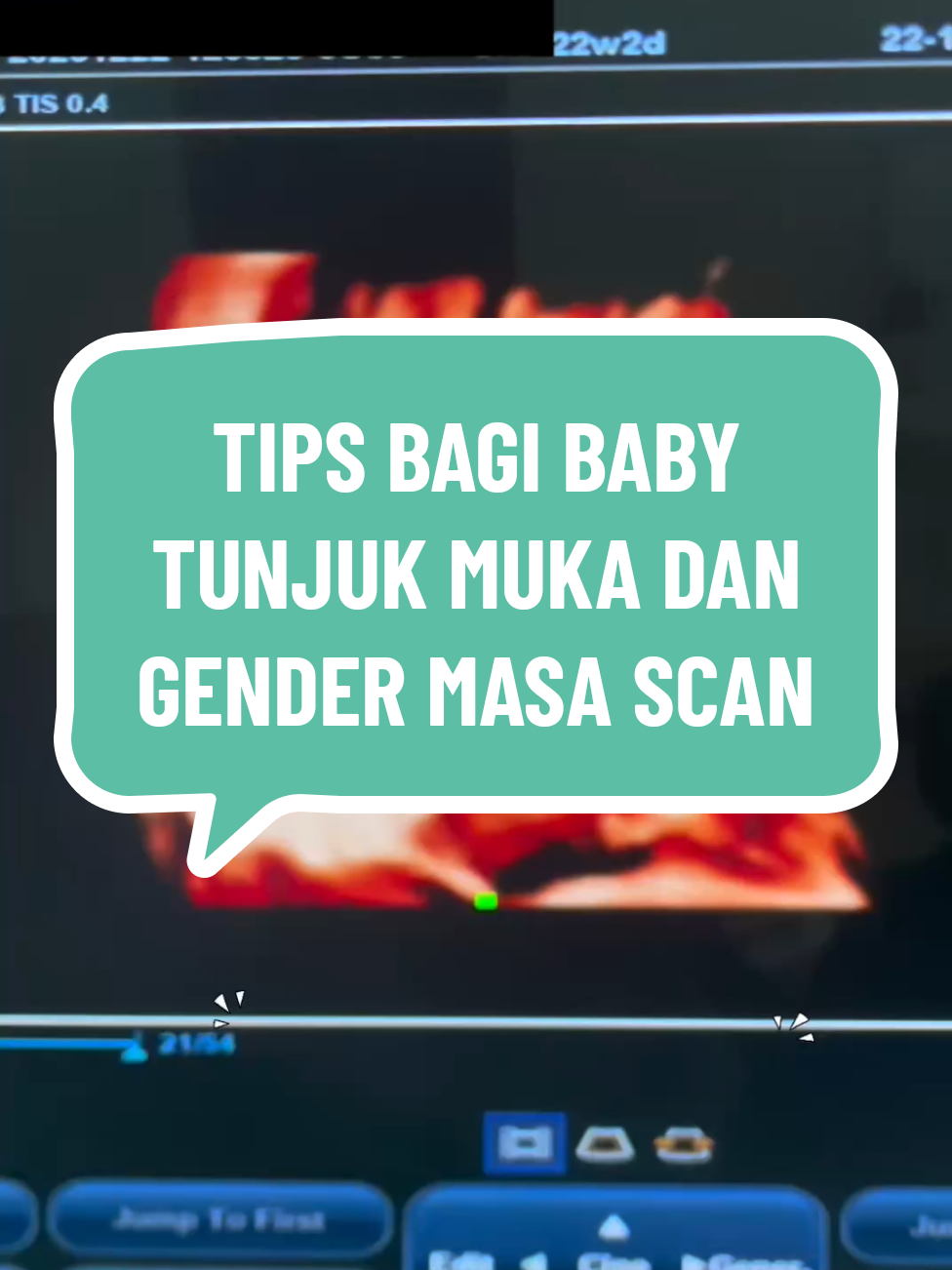 @Klinik Dr Engku Bahiyah