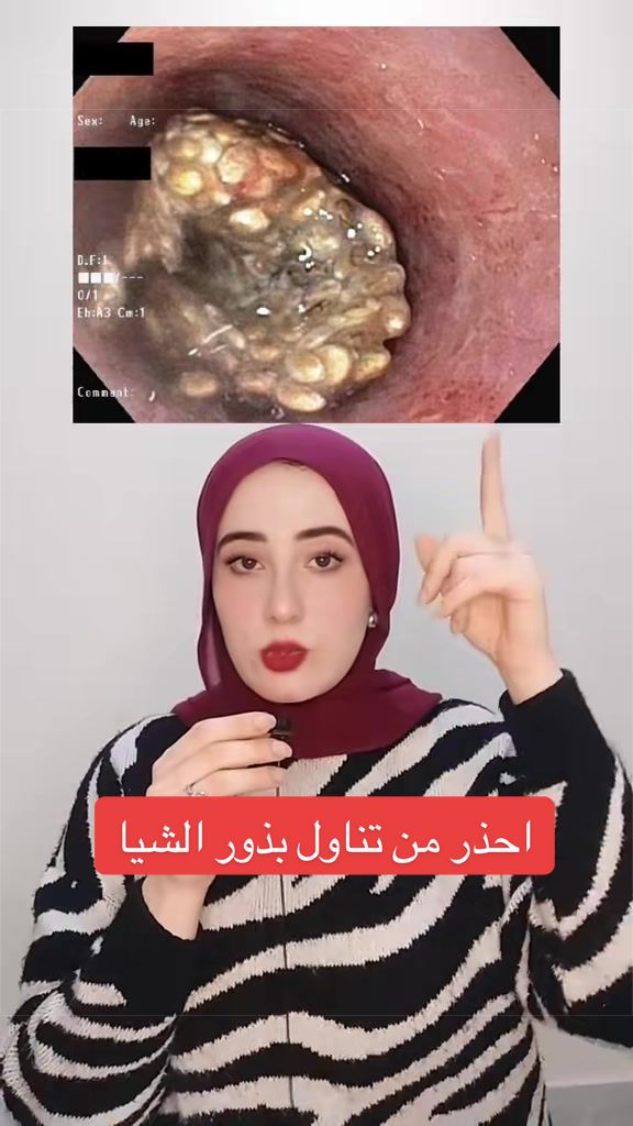 @Dr Summer Alaa | Msc,