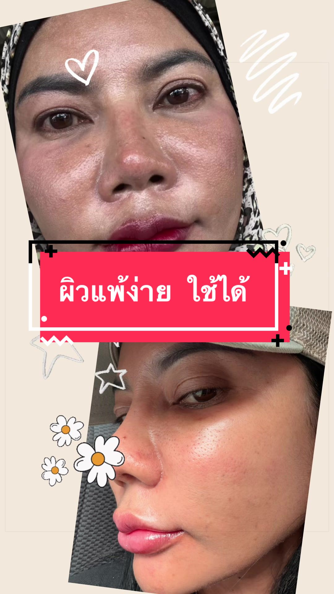 @นัตตี้คือความโชคดี