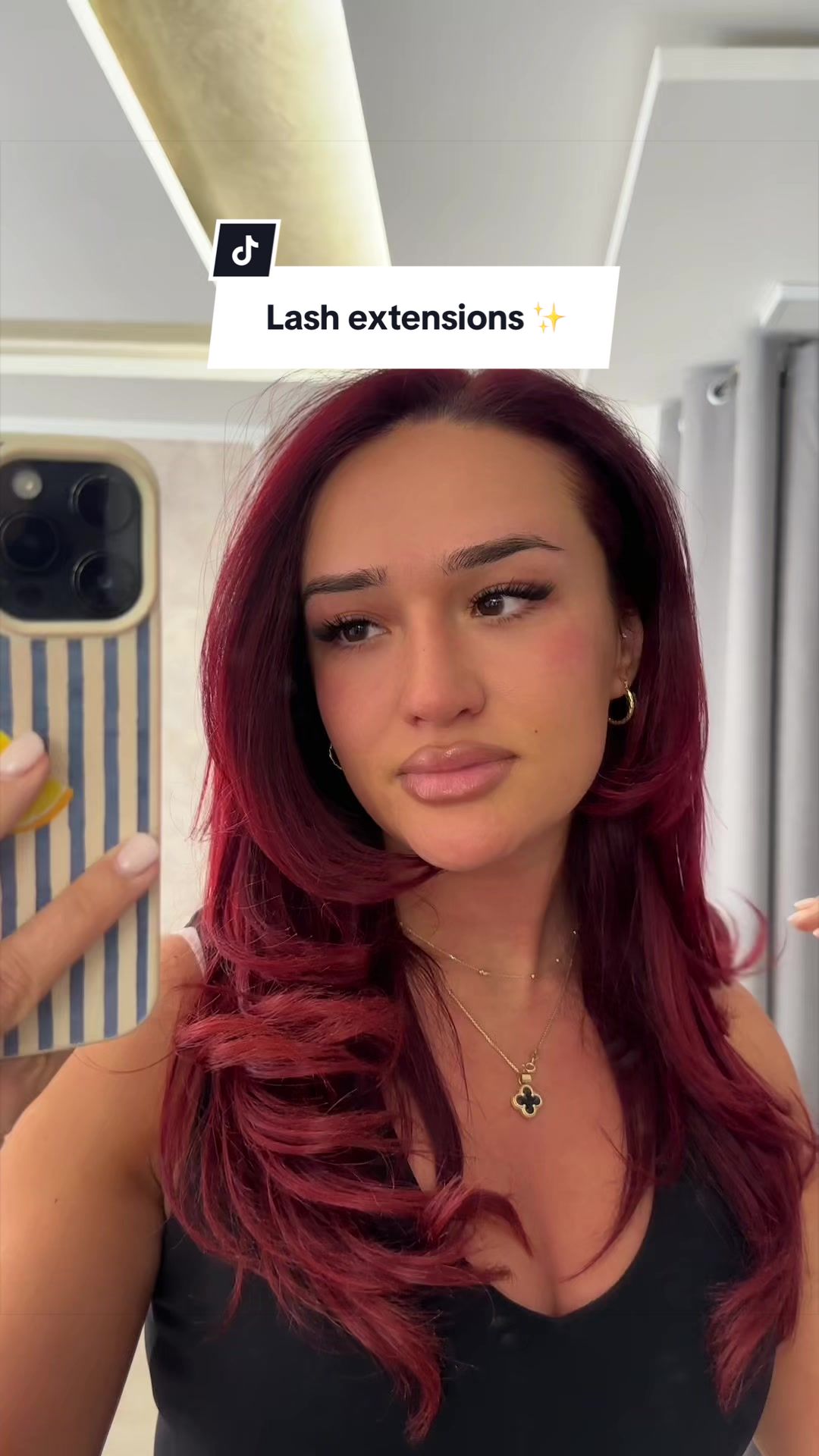 @erakastrati