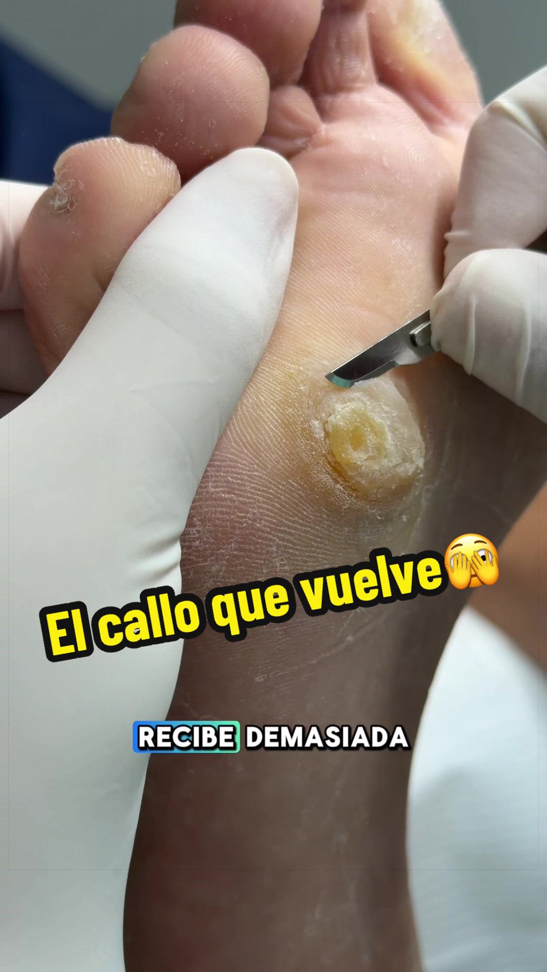 @podología calzada