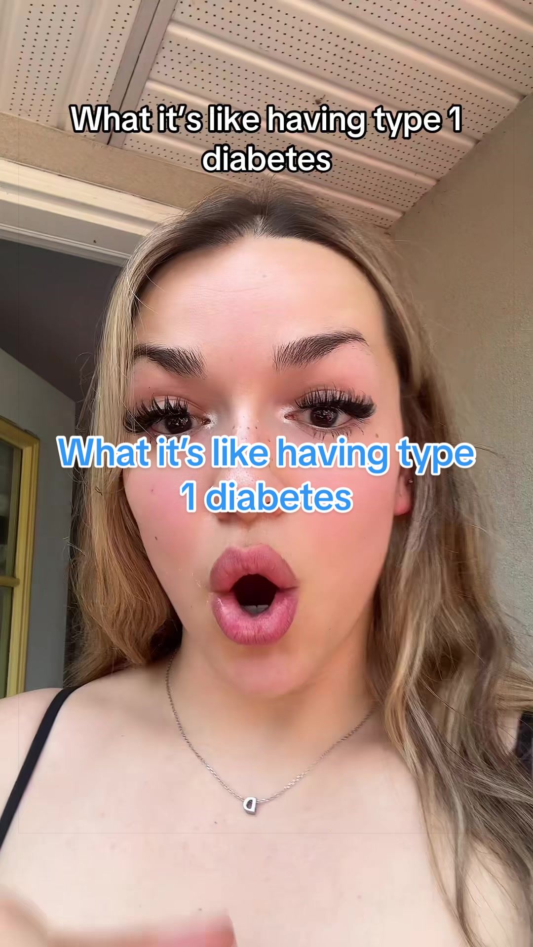 @TYPE 1 DEEABETES