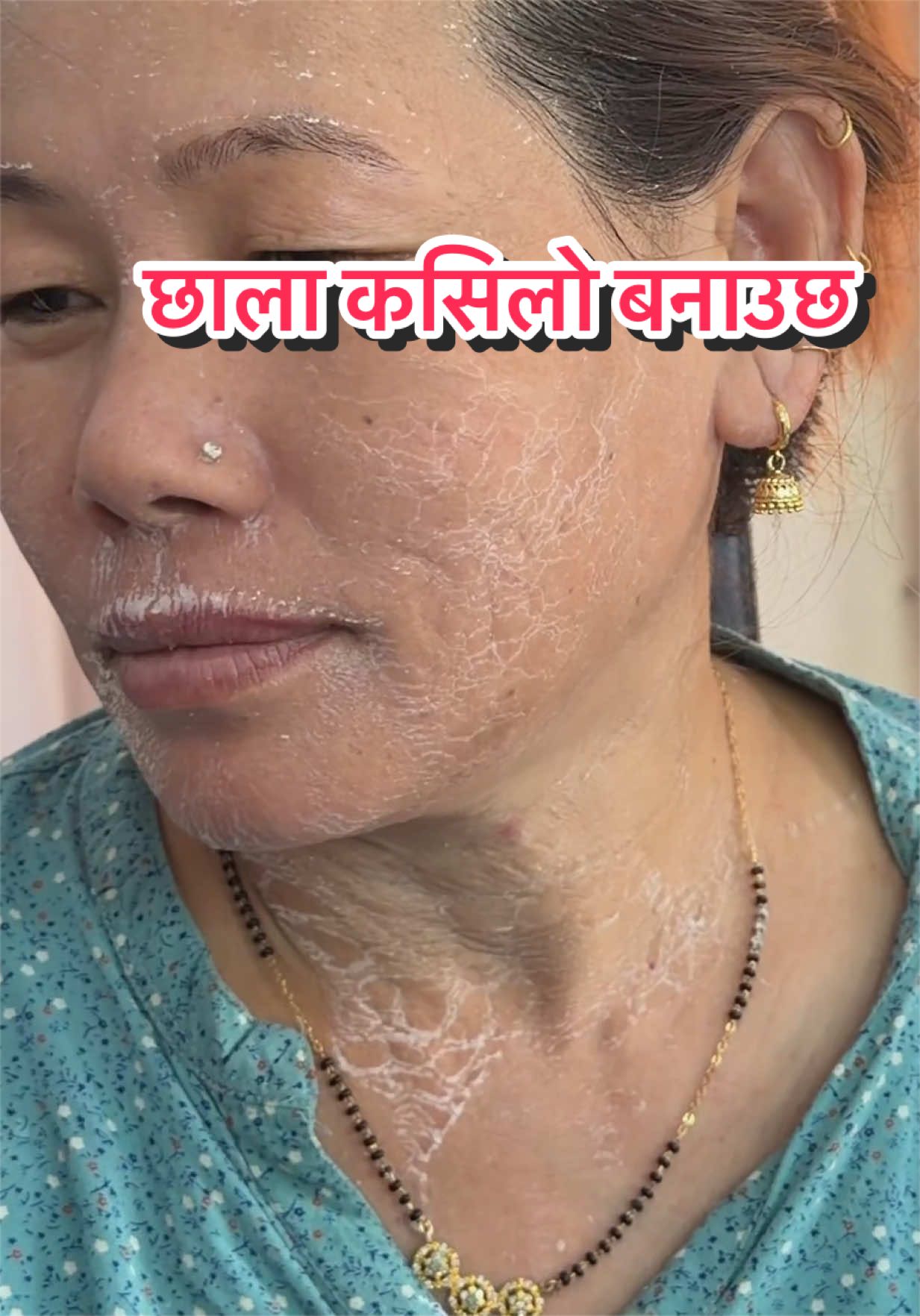 @Minimagic Skincare🇳🇵
