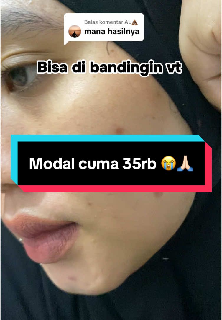 @Penghilangtahilalat.kaq.ay