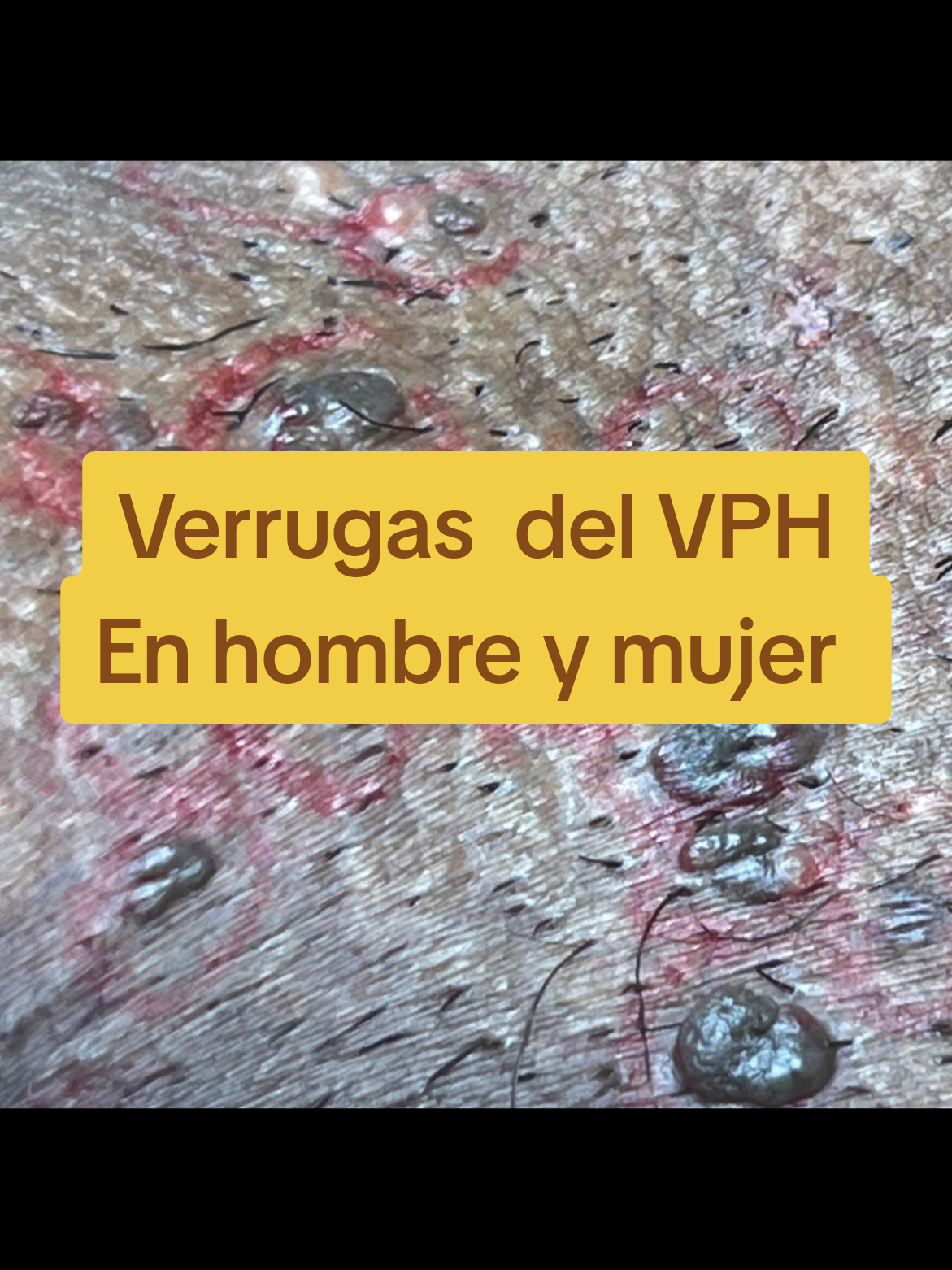 @VPH2025