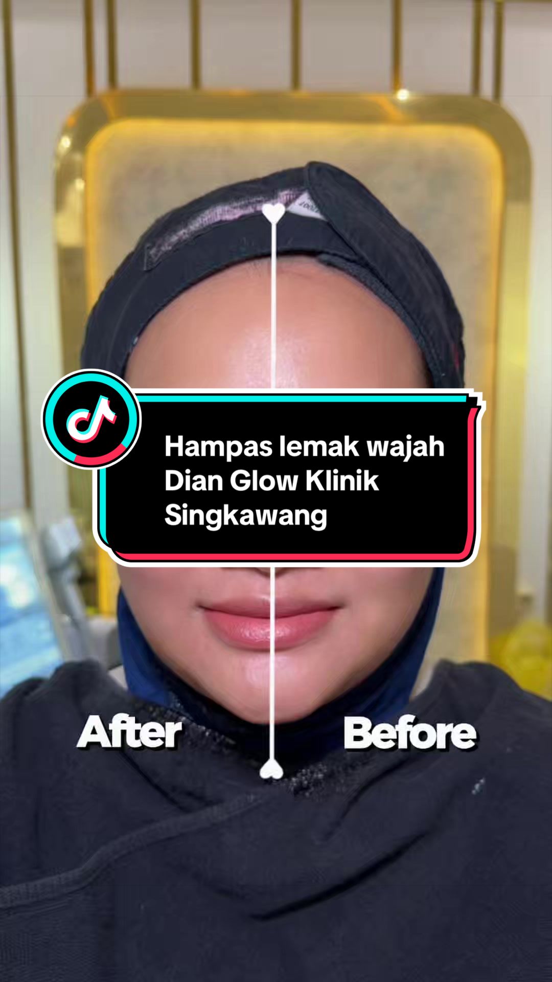 @Nurul Hanifa Sharma