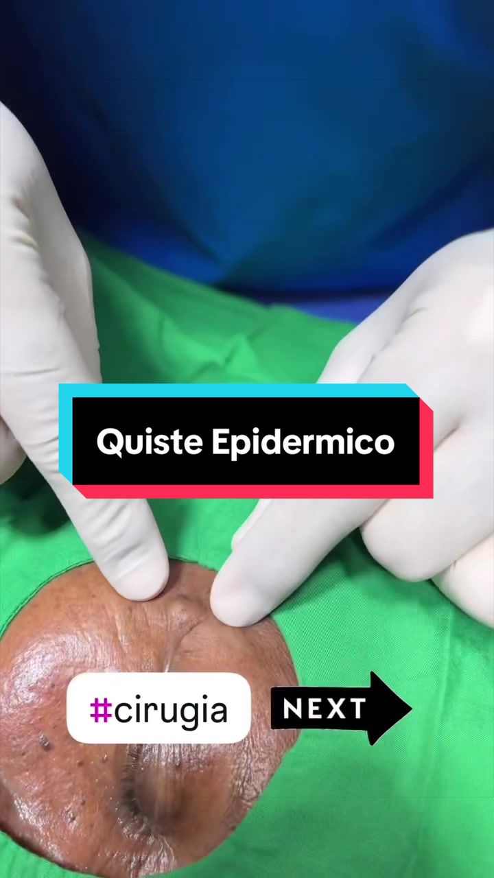 @Dr. Wilfrido Solano Derma