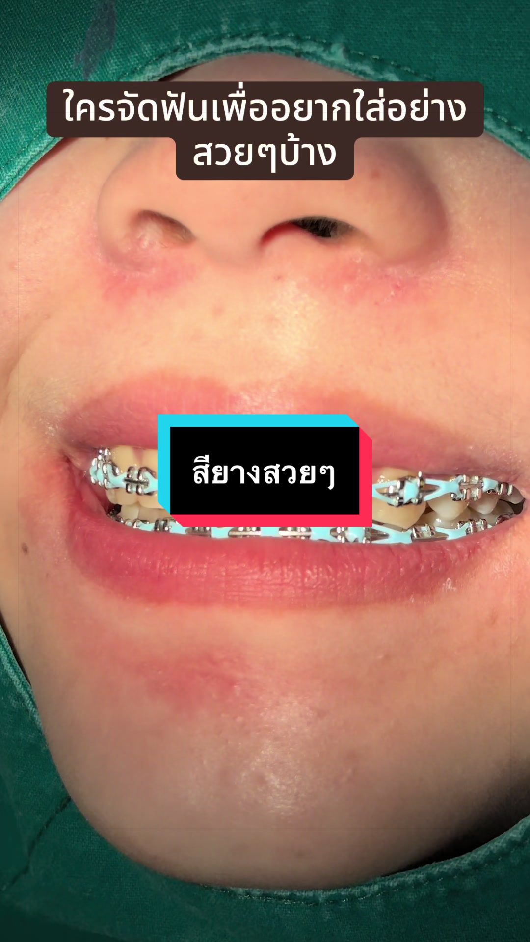 @ซอฟแอนด์สไมล์ลาดกระบัง